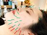 【フェイスライン(あご下)を集中ケア☆】Vシャープ美容鍼 50分/12000→9000