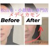 メディカモン(medikamon)のお店ロゴ
