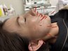 【たるみ・肩こり・睡眠改善】美容鍼30分＋全身マッサージ30分