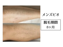 メンズビオ 神戸三宮店/