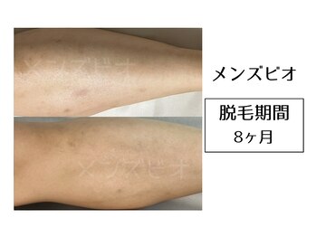 メンズビオ 神戸三宮店/