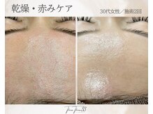 スリースリー(THREE THREE)/乾燥・赤みケア