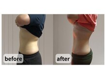 ニーコ 新宿御苑前(Niico)/30代前半 女性/90分コース×3回