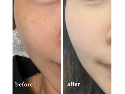 アリュール(Allure)の写真