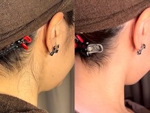 産毛処理お任せください！土日祝電話対応してます！