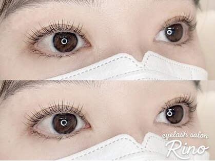 リノ(Rino)の写真