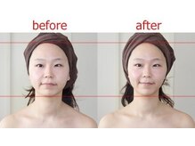 アゴラ/【小顔矯正】豊富な施術実績有り