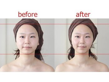 アゴラ/【小顔矯正】豊富な施術実績有り