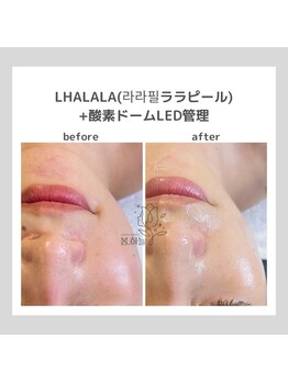 ポムハヌル(pom.haneul)/韓国肌管理室