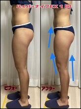 リヘッド(Re.head)/ハイパーナイフEXでヒップアップ