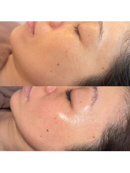 エースビューティー(Ace.Beauty)/vosサロンケア