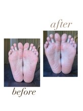 ワイエー(ya)/足つぼでスッキリ！