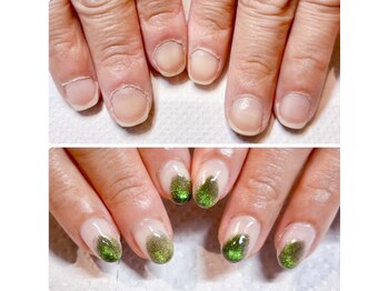 ビビネイル(BIBI Nail)の写真/【美しくなっていく自爪に感動♪】深爪・横平爪など爪の形に自信がない方も見惚れる指先に導く本格育爪★