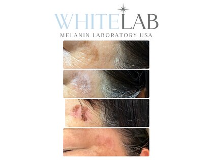 ラヌイ(LANUI)の写真