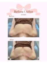 ロココ 心斎橋店(Rococo)/心斎橋バストアップサロン