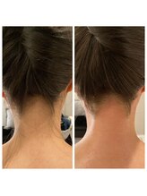 パームスエル(palms.L)/《うなじ脱毛》