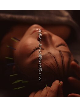 アロエベル(aloe Belle)/オーダーメイド施術★