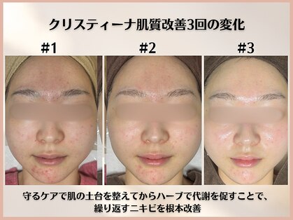 シンスプラス(SINCE+)の写真