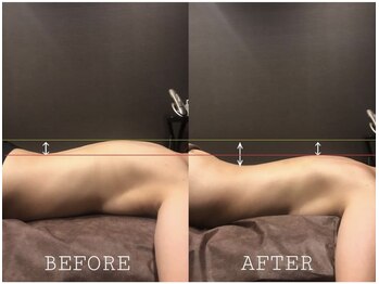 エステサロン シュール