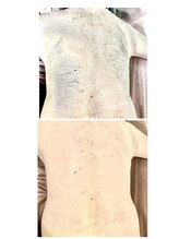 エン(en.)/BeforeAfter写真7