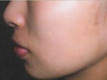 カルム(calme)の雰囲気（⇒見違える程美肌に！なりたいお肌になれる喜びを感じられる◎）