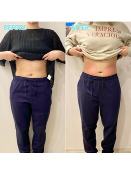 心斎橋長堀フェムテック整骨院/脂肪冷却 整体 心斎橋 大阪