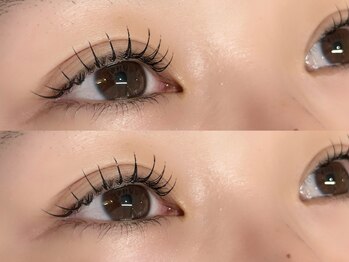 ウル(ulu)の写真/【目元パッチリ★】豊富な種類からあなたの理想のデザインに◎お悩みも魅力に変える丁寧×高技術な施術♪