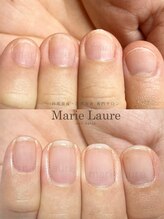 マリーロール 淀屋橋本店(Marie Laure)/自爪育成/深爪矯正/ネイルケア