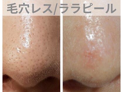 チャパン(Chapan)の写真