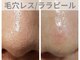 チャパン(Chapan)の写真