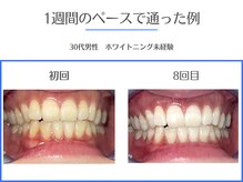 エクシアホワイトニング 岡崎店/感動の変化★岡崎No.1の来店者数