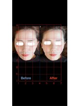 美容矯正サロン レレポノ(LELEPONO)/