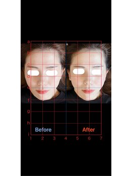 美容矯正サロン レレポノ(LELEPONO)/
