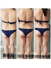 ティアラ(TIARA)/痩身