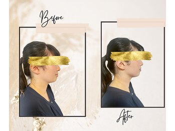 ラネージュ(LA NEIGE)/【札幌LA NEIGE】小顔/リフトUP