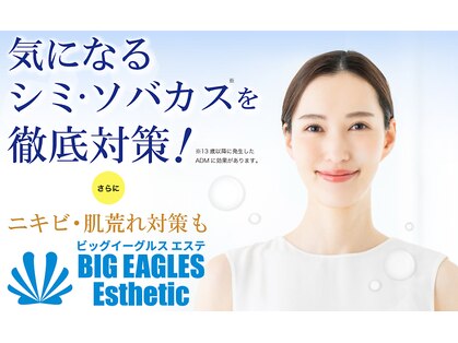 ビッグイーグルス エステの写真