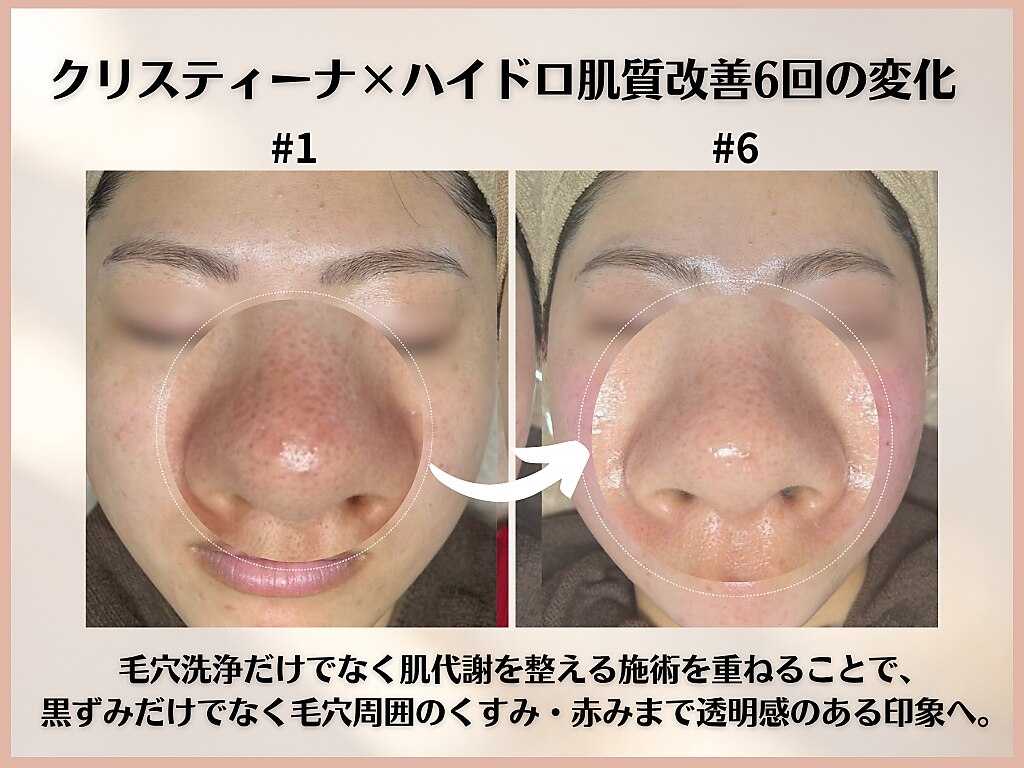 シンスプラス(SINCE+)｜ホットペッパービューティー