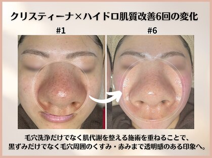 シンスプラス(SINCE+)の写真