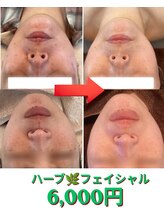 ファム 蓮台寺店(FAM)&nbsp;シミ　肝斑 ニキビ改善