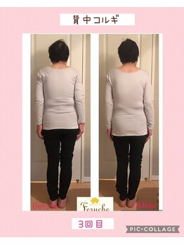 小顔コルギ専門店 フェルーシュ 成田駅前店(Feruche)/丸まった背中すっきり(70代女性)