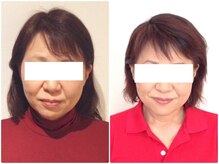 ウェリナ平和堂長久手院/小顔矯正/骨盤矯正/痩身/整体