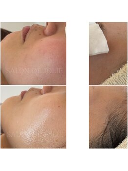 サロンドジョリー/きらめく艶玉