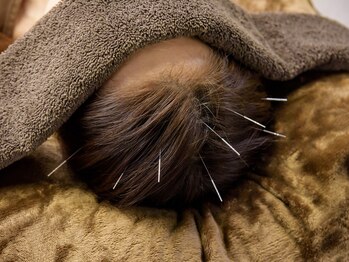 やぎおか堂/鍼灸