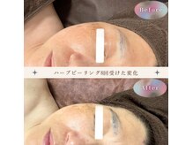 年齢とともに気になるシミしわ改善