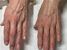 ラ リノ(La-Rino.)/手の病院サロントリートメント