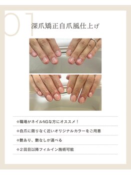 ピノ(pino)/◆深爪矯正＋自爪風仕上げ◆