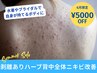 夏直前SALE!背中全面剥離ハーブピーリング【5000円OFF】顔の3倍量:足も可能