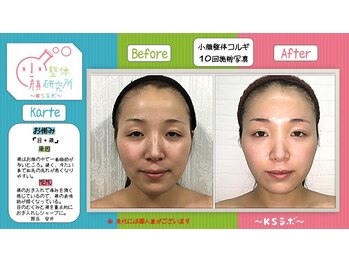 小顔専門小顔コルギ 金沢竪町店/経過