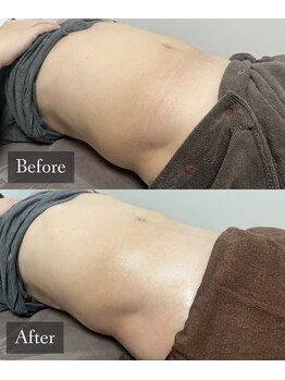 ベルフィーヌ 恵比寿店(BELFINE)/すっきり美ボディ