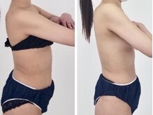 サロン ド プリゼ(salon do Purize)/筋膜リリース